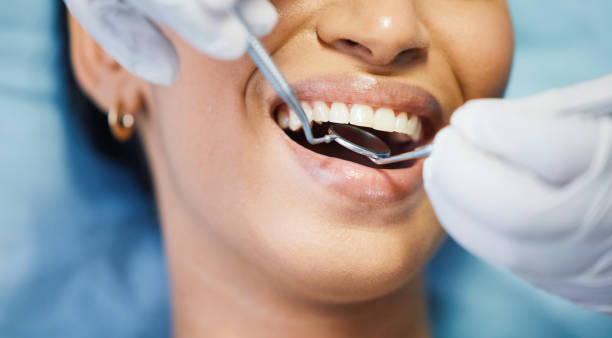 Best Emergency Broken Tooth Repair in Steele, AL