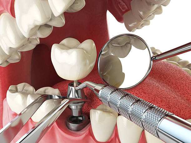 Best Emergency Treatment for Toothache in Steele, AL
